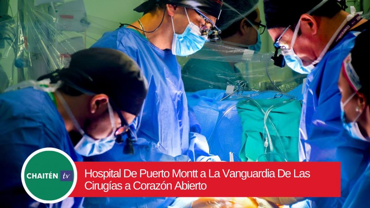 Hospital De Puerto Montt a La Vanguardia De Las Cirugías a Corazón Abierto